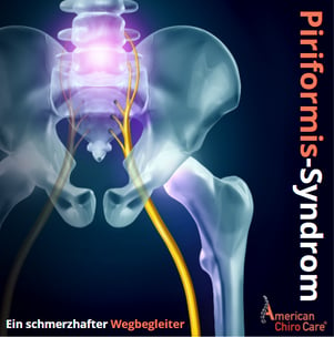 Piriformis-Syndrom Abbildung